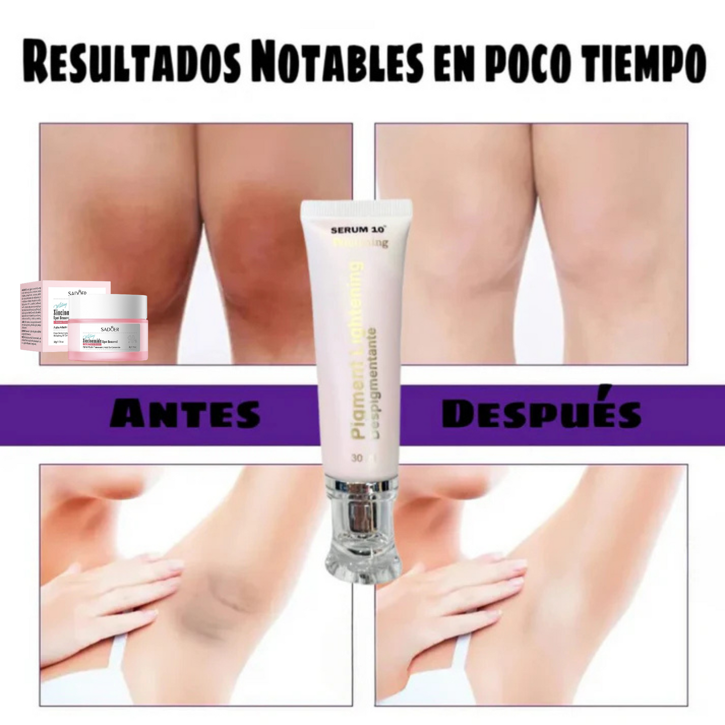 Pigment Lightening™ | Serum Despigmentante + Antimanchas Zona Intima, Codos Y Rodillas 🎁